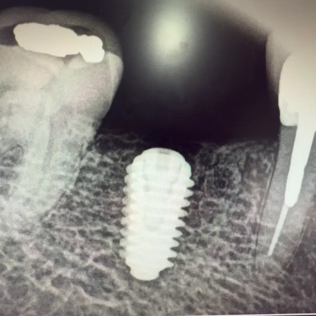 What Implant Is That database logo